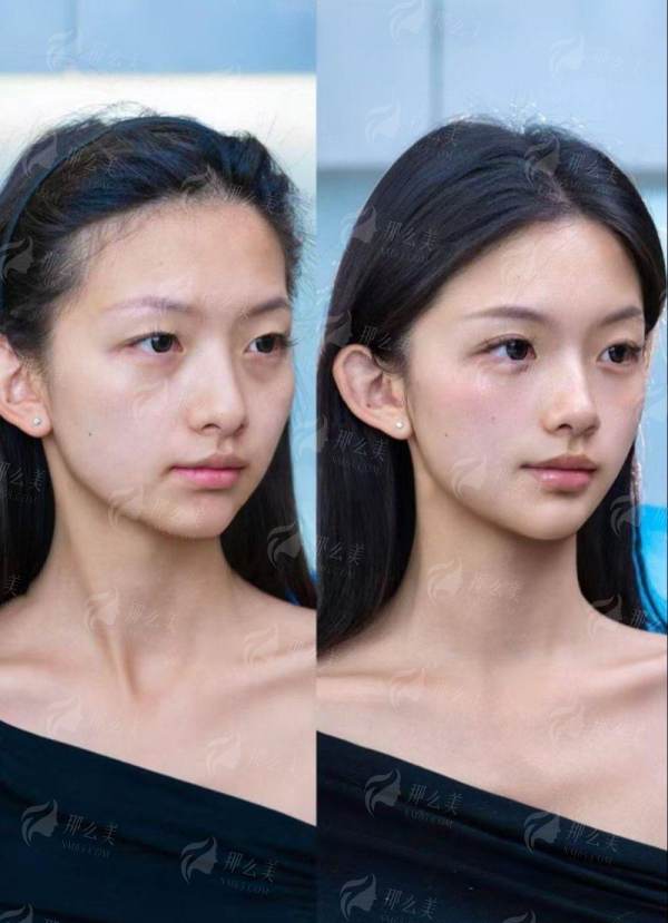 三、金荣vs煤医尚美怎么选？