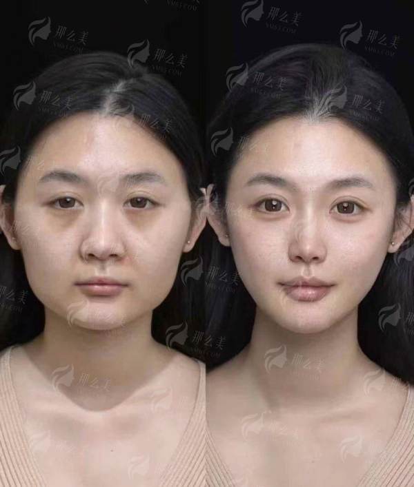 四、重庆长良医疗美容如何预约李敏医生？