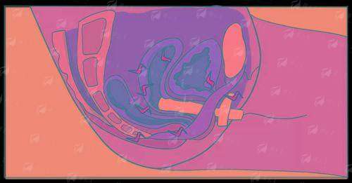 一、北京新星靓的阴道紧缩手术怎么样？