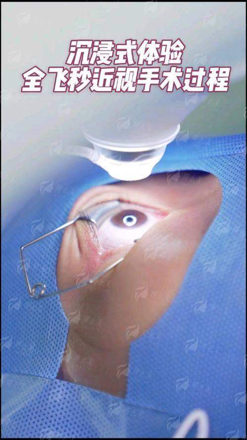 三、在温州华厦眼科做飞秒激光手术要注意什么？