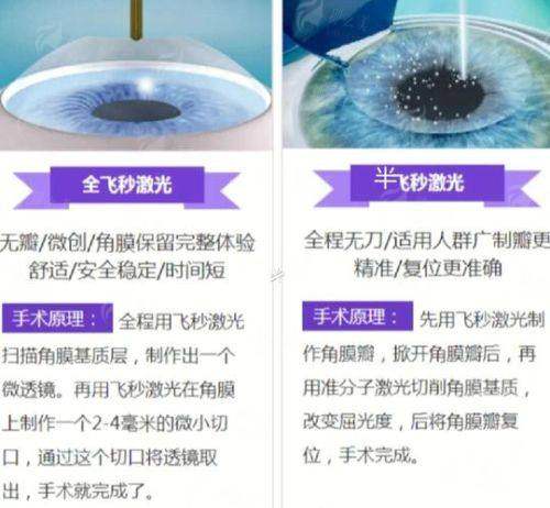 四、如何预约温州华厦眼科的飞秒激光手术？