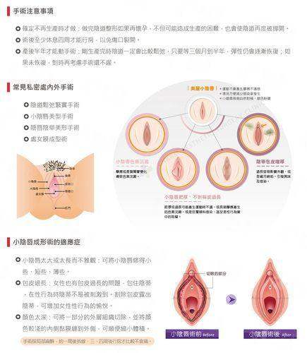 合肥民众医院私密科小阴唇整形怎么样？看用户反馈，新颜智尚可约还能了解价格