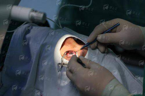 三、合肥普瑞眼科医院的飞秒激光手术有哪些优势？