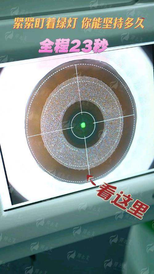 三、张彩霞精细蔡司全飞秒的患者反馈