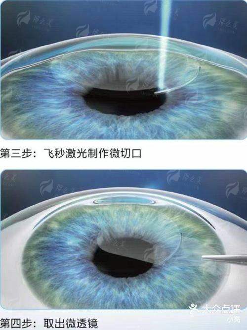 二、苏州眼耳鼻喉科医院的全流程服务