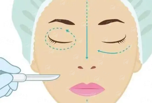 二、张兆博双眼皮手术有哪些优势？临汾美特尔整形服务如何？