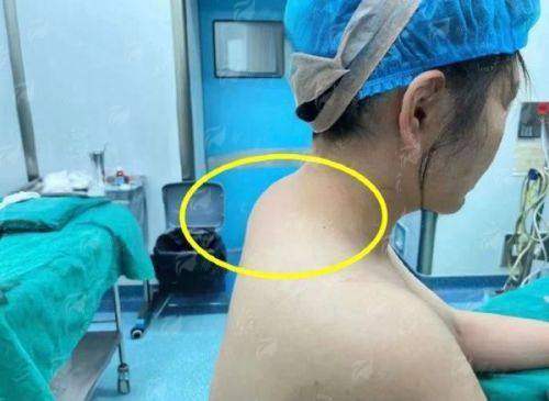 三、江苏苏州铂蔓医疗美容做富贵包整形要多少钱?