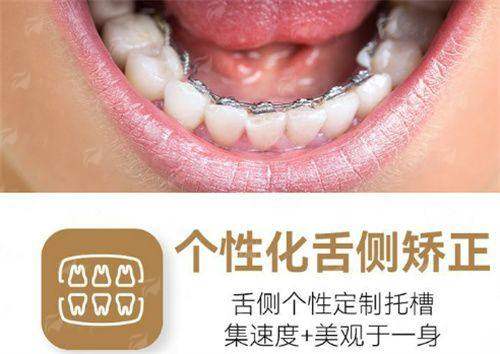 一、兰州润玉口腔的隐形矫正技术怎么样?