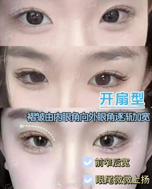 想拥有迷人双眼皮？广州可玉医疗美容一键预约，了解价格优惠攻略，还有案例推荐哦