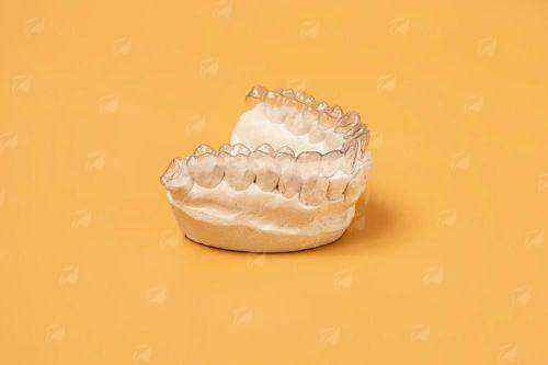 四、深圳汇港口腔牙齿隐形矫正如何预约?