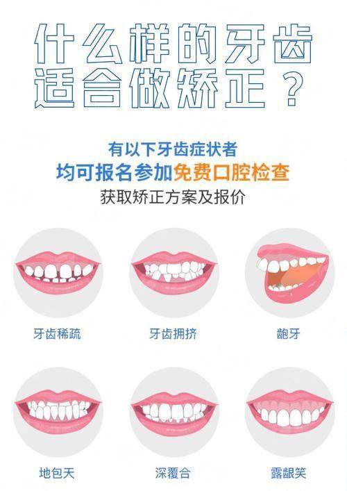 二、深圳汇港口腔牙齿隐形矫正适合哪些人?