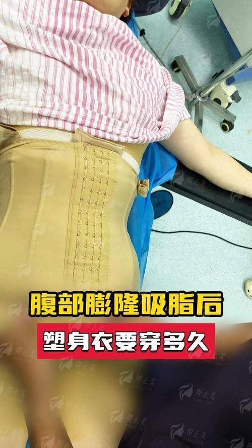 二、腰腹吸脂在广州雅贝壹要花多少钱？