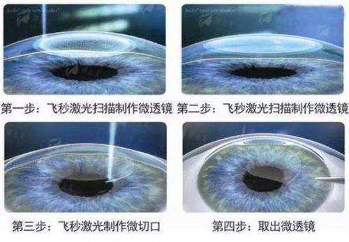 
外地宝子别愁！金华文龙眼科预约难？新颜智尚一键查询，教你正确预约路径，少等不白跑，附预约方式