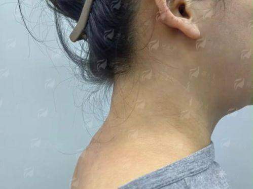 二、江苏苏州铂蔓医疗美容的富贵包整形医生团队靠谱吗?