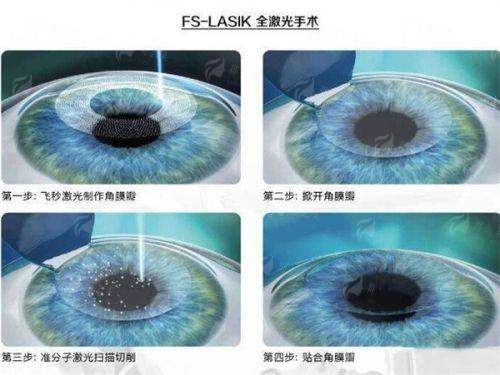 <strong style="color:red;">金华眼科医院公益项目</strong>