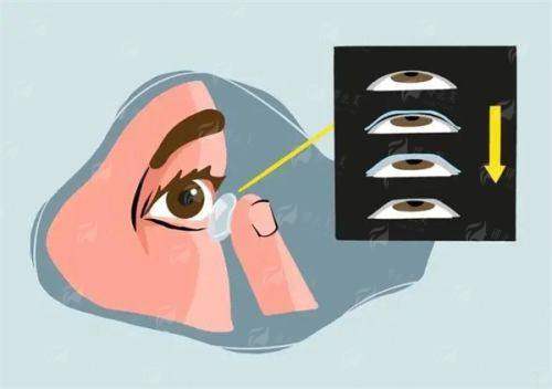 <strong style="color: red;">如何选择适合自己的眼科医院?</strong>