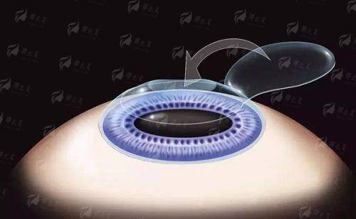 <strong style="color: red;">如何预约宁波爱尔光明眼科医院？就诊指南请收好</strong>