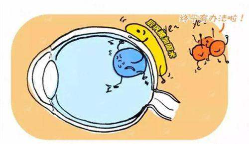 <strong style="color: red;">镜片升级优惠方案</strong>