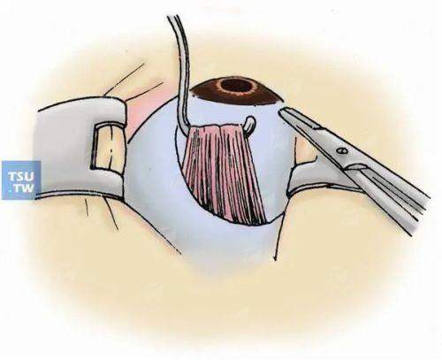 <strong style="color: red;">为什么选择西安医学高等专科学校附属医院口腔科？</strong>