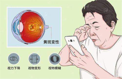 <strong style="color: red;">眼科诊疗：从儿童近视到老年白内障的全生命周期守护</strong>