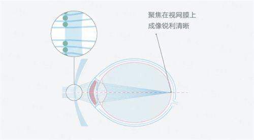 <strong style="color:red;">五、怎么选择长春近视手术医院？</strong>