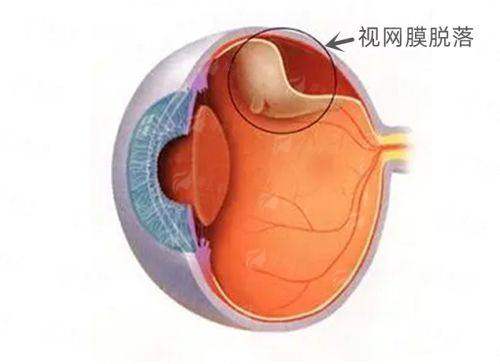 <strong style="color: red;">菲越企鹅眼科：专精医生团队</strong>