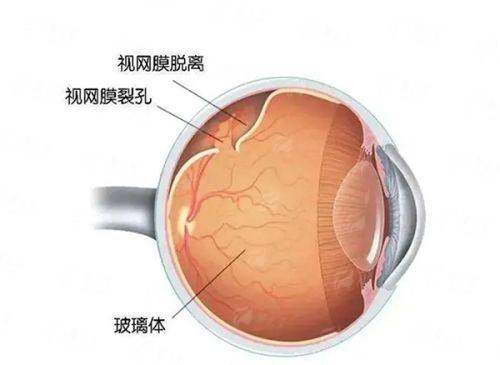 深圳明德眼科怎么样？实测告诉你，专业设备+经验医生，让你告别眼部烦恼！附预约方式