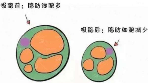  合肥维多利亚整形口腔医院梁怀兰口周注射抗衰特色在哪？预约方式与口碑来揭晓-24小时新颜智尚小程序预约