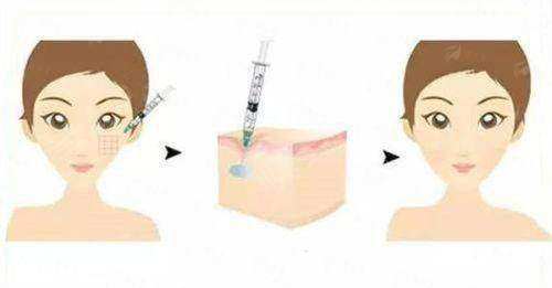三、广州建国医院的处女膜修复手术有什么优势?