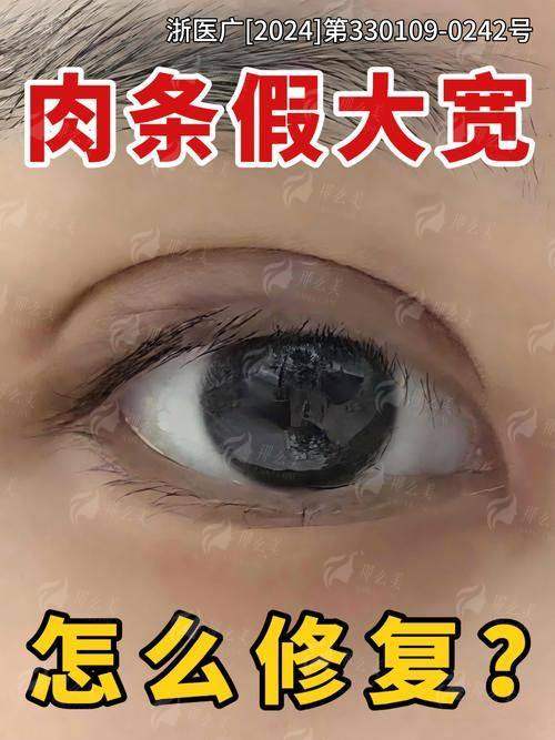 三、平顶山星美杨召辉医生双眼皮术后如何护理？