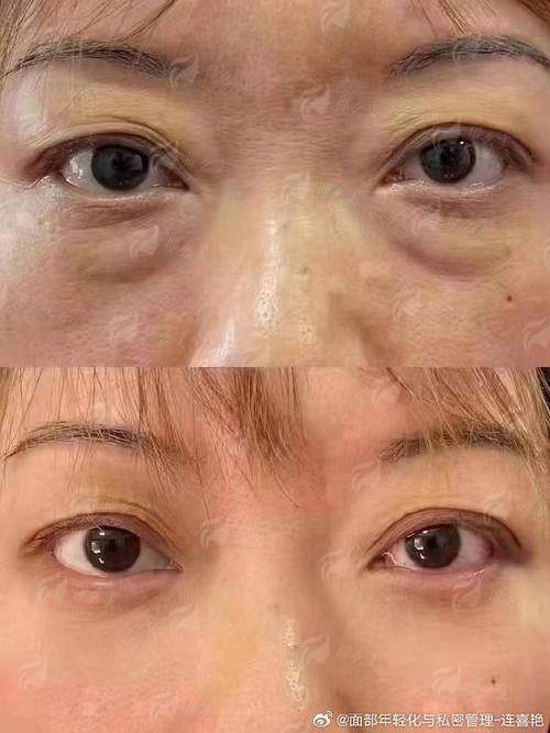 二、湖北宜昌亚太整形美容医院的祛眼袋医生团队实力如何?