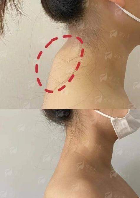 二、超微乳化祛富贵包适合你吗?先看这些硬指标