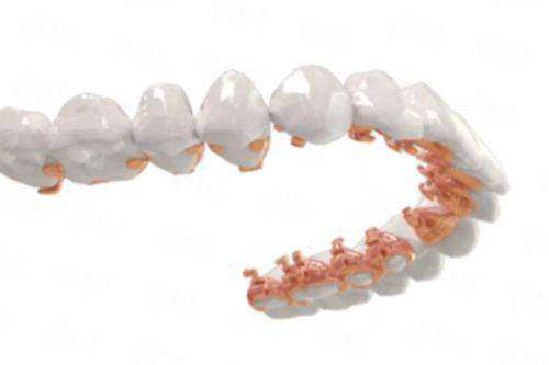 三、真实实例:32岁白领的种植牙经历