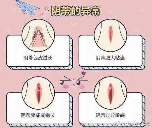 三、在长春融美整形做房永刚医生双眼皮要多少钱?