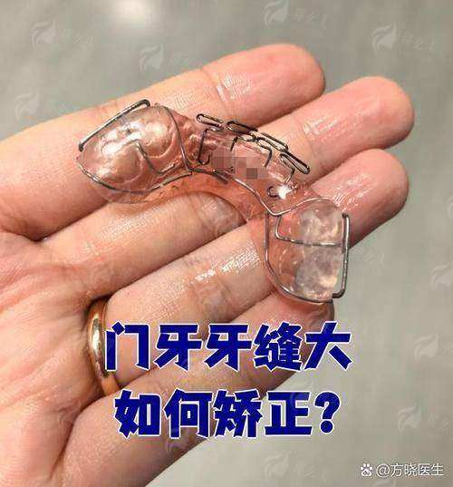 一、固瑞英族口腔门诊正规吗?看这3点硬实力