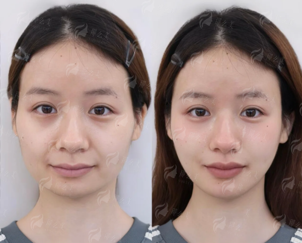 <strong>二、兰州时光激光整形美容医院：激光美容的领跑者</strong>