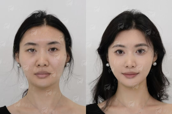 <strong>三、兰州韩美整形：韩系风格的时尚之选</strong>