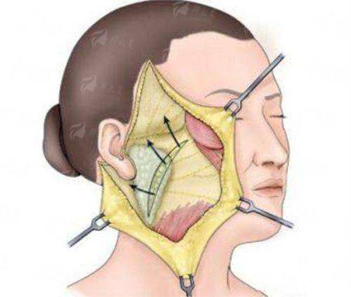 二、深圳宝丽医疗美容隆鼻医院价格与技术对比