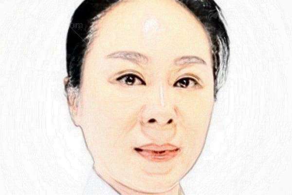 鞍山燕丽美容医院张磊祛眼袋效果怎么样？真实案例分析给你答案-新颜智尚小程序一键预约！