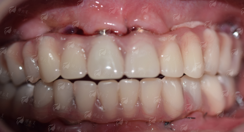 天津塘沽庆福华口腔诊所怎么样？看这一篇就够了！