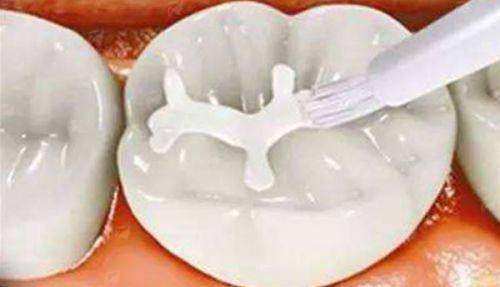 四、真实实例参考