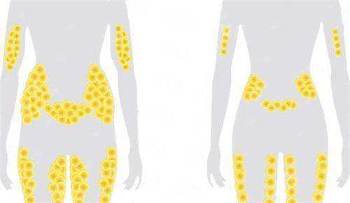 四、如何预约东莞壹加壹整形美容医院的大腿吸脂服务？