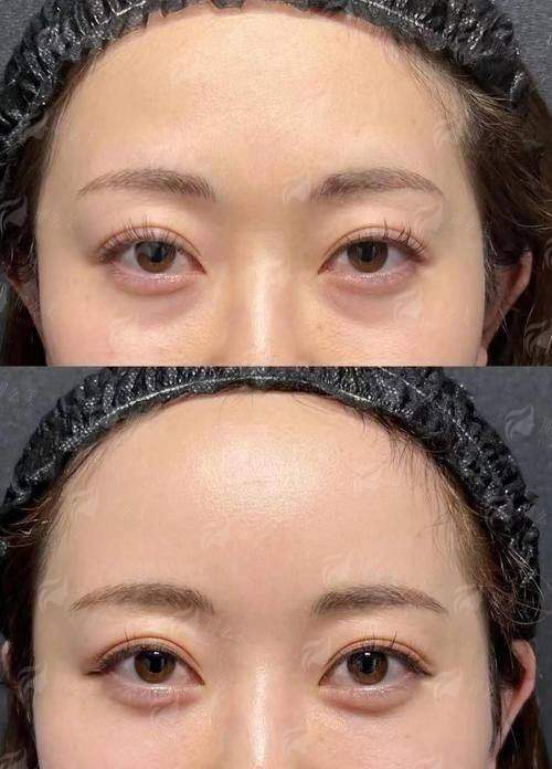 三、除了手术，南通爱时光医疗美容还有哪些“无痕”选择？