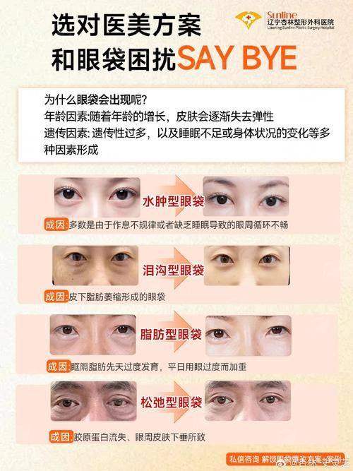 想预约南通爱时光无痕眼袋？新颜智尚小程序可约，看案例推荐与价格优惠攻略