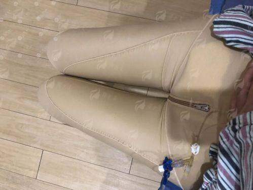 三、在东莞壹加壹整形美容医院做大腿吸脂的价格与流程是怎样的？