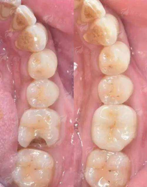 三、价格贵不贵？全新项目收费表