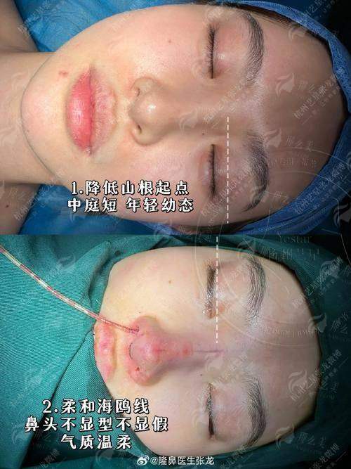 三、在西安叶子医疗美容医院找朱健康院长做鼻修复，如何预约与沟通？