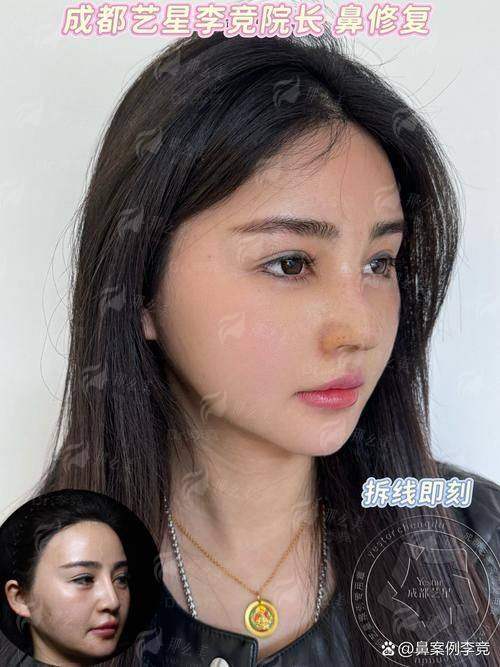 想预约西安叶子朱健康院长做鼻修复？新颜智尚小程序一键预约