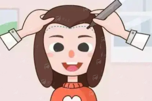 厦门发际线种植价格多少？新禾曙光植发10元/毛囊单位起，附案例推荐与预约方式