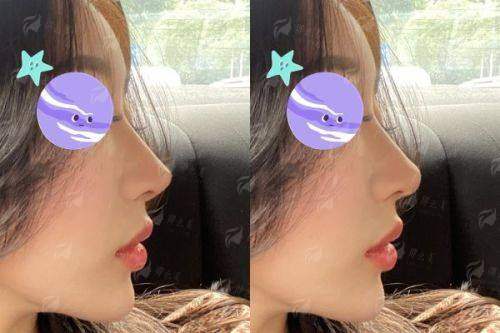 四、广州曙光的程鹏隆鼻,该如何预约与询问?